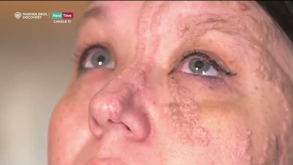 copertina Dr. Pimple Popper: la dottoressa schiacciabrufoli