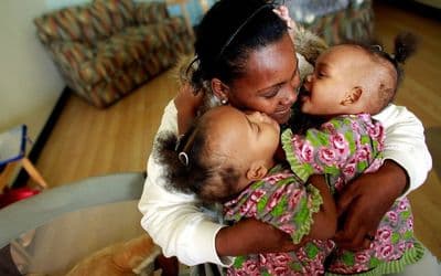 copertina del programma Storie di gemelli siamesi